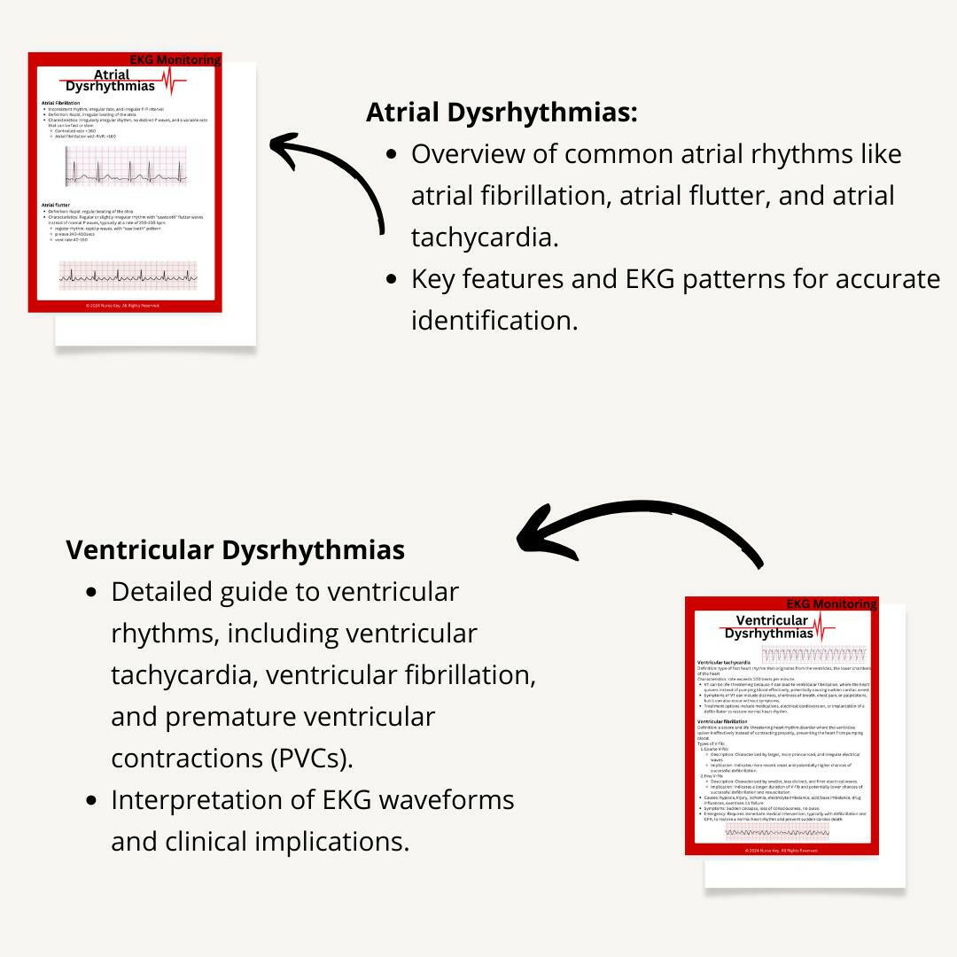 EKG Basics eBook - Nurse Unlocked