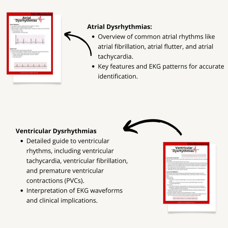 EKG Basics eBook - Nurse Unlocked