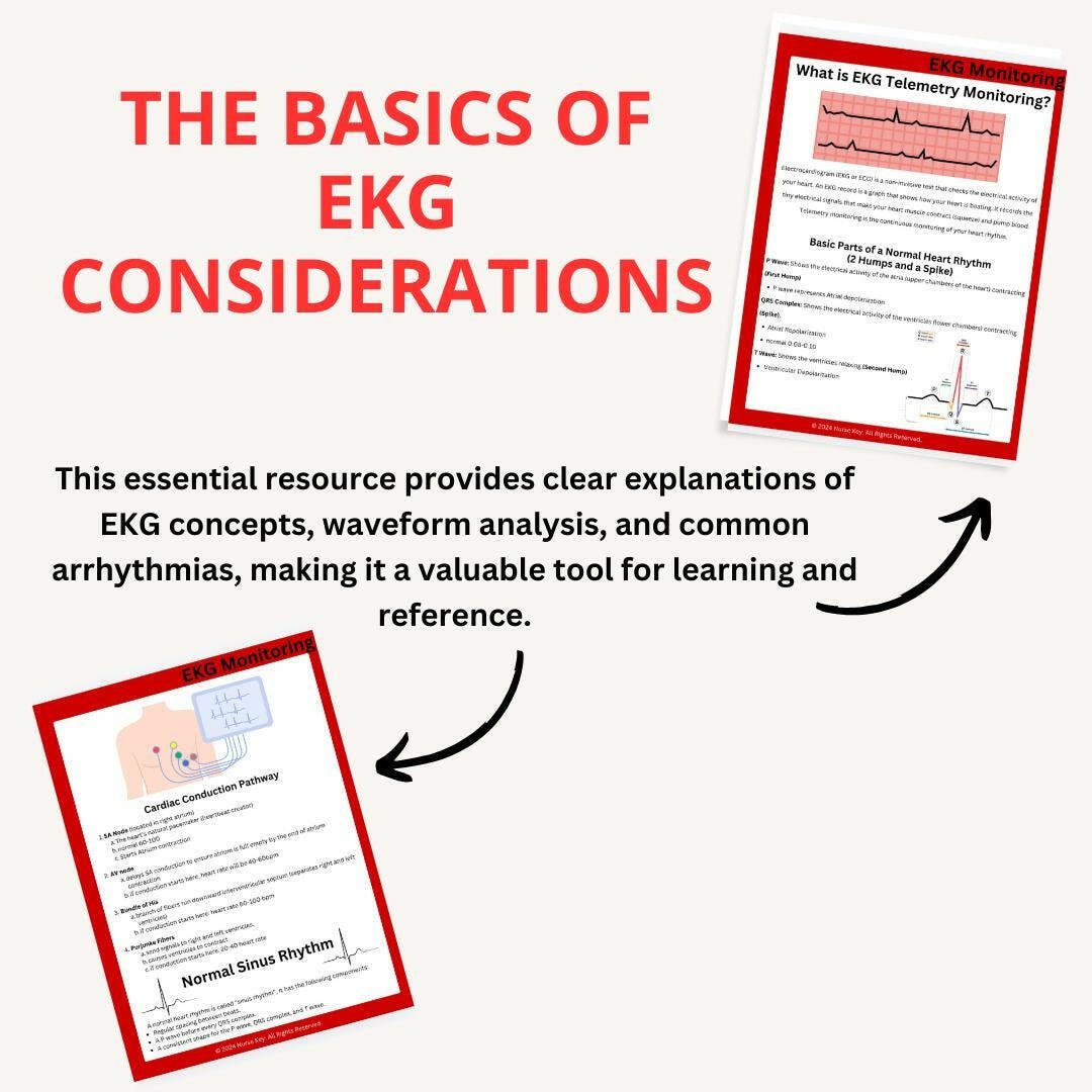 EKG Basics eBook - Nurse Unlocked